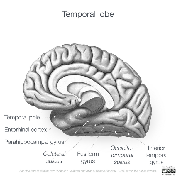 File:Neuroanatomy- medial cortex (diagrams) (Radiopaedia 47208-52697 Temporal lobe gyri 4).png