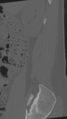 Normal lumbar spine CT (Radiopaedia 46533-50986 Sagittal bone window 91).png