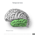 Neuroanatomy- lateral cortex (diagrams) (Radiopaedia 46670-51156 Temporal lobe 3).png