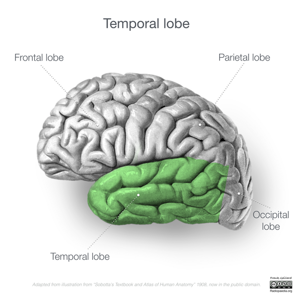 File:Neuroanatomy- lateral cortex (diagrams) (Radiopaedia 46670-51156 Temporal lobe 4).png