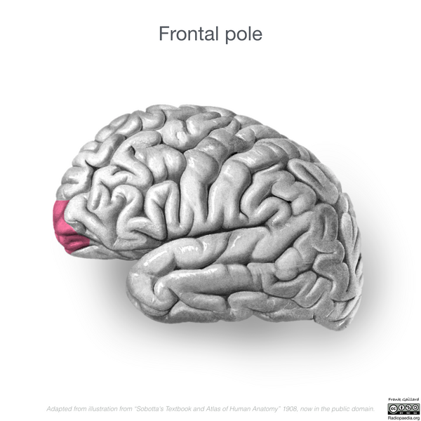 File:Neuroanatomy- lateral cortex (diagrams) (Radiopaedia 46670-51313 Frontal pole 3).png