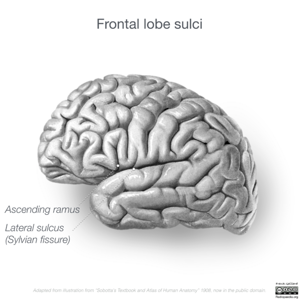 File:Neuroanatomy- lateral cortex (diagrams) (Radiopaedia 46670-51202 C 11).png