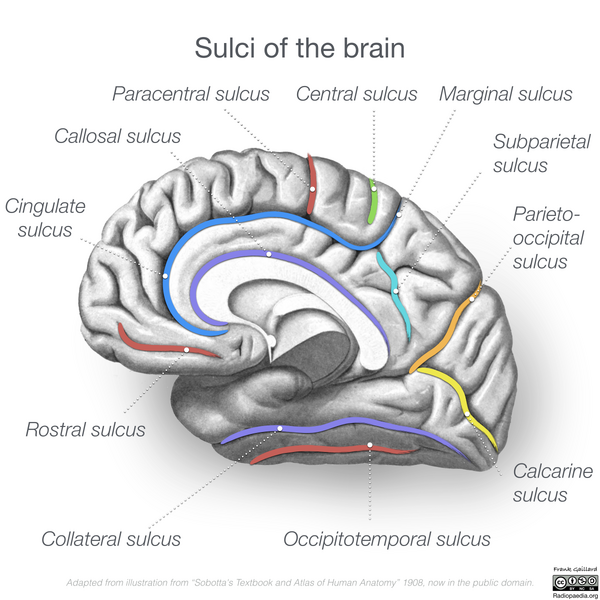 File:Neuroanatomy- medial cortex (diagrams) (Radiopaedia 47208-58969 Whole brain sulci 3).png