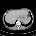 Normal multiphase CT liver (Radiopaedia 38026-39996 C 12).jpg