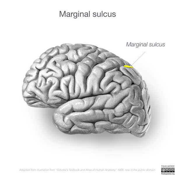 File:Neuroanatomy- lateral cortex (diagrams) (Radiopaedia 46670-51202 Marginal sulcus 1).png