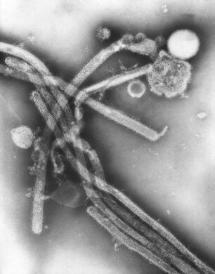 TEM image revealed the presence of a number of Hong Kong Flu virus virions, the H3N2 subtype of the Influenza A virus.