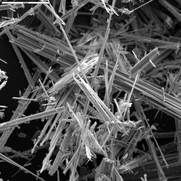 File:Asbestos - anthophyllite (photo) (Radiopaedia 8739).jpg
