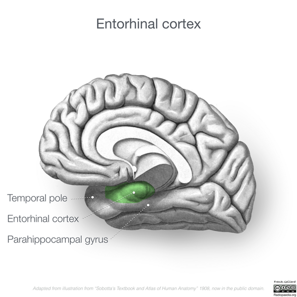 File:Neuroanatomy- medial cortex (diagrams) (Radiopaedia 47208-52697 Entorhinal cortex 1).png