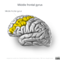 Neuroanatomy- lateral cortex (diagrams) (Radiopaedia 46670-51313 Middle frontal gyrus 1).png