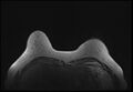 Normal breast MRI - dense breasts (Radiopaedia 80454-93850 Axial T1 40).jpg