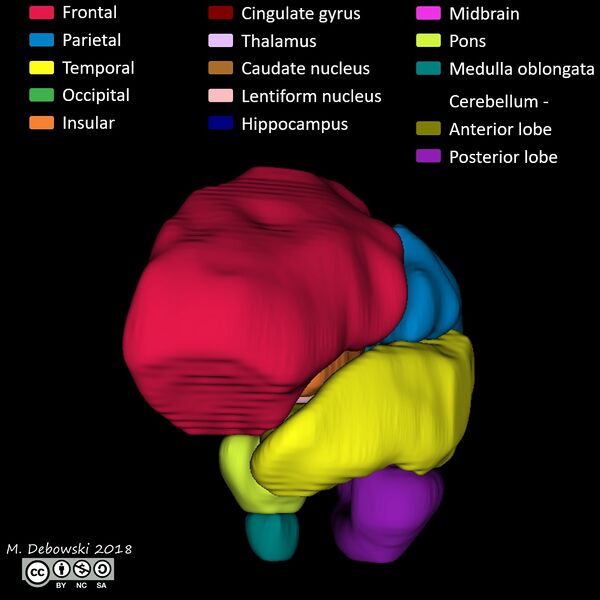 File:Brain lobes - annotated MRI (Radiopaedia 61691-69700 3D reconstruction 26).JPG