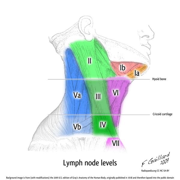 File:Lymph node levels (illustration) (Radiopaedia 9618).jpg
