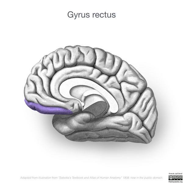 File:Neuroanatomy- medial cortex (diagrams) (Radiopaedia 47208-52697 Gyrus rectus 3).png