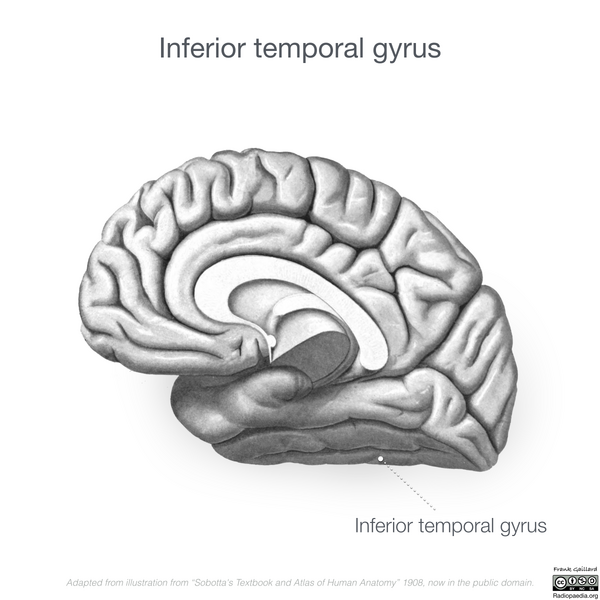 File:Neuroanatomy- medial cortex (diagrams) (Radiopaedia 47208-52697 N 7).png