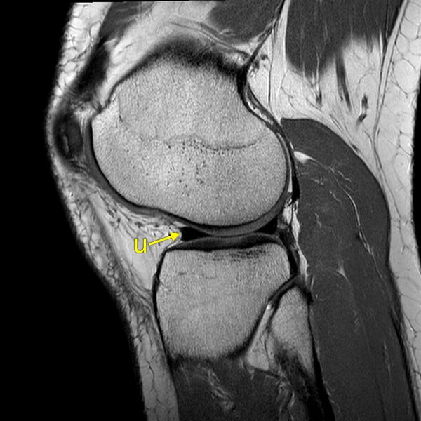 File:Anatomy Quiz (MRI knee) (Radiopaedia 43478-46865 A 20).jpeg