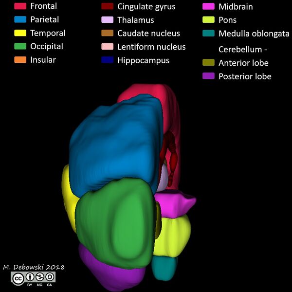 File:Brain lobes - annotated MRI (Radiopaedia 61691-69700 3D reconstruction 66).JPG