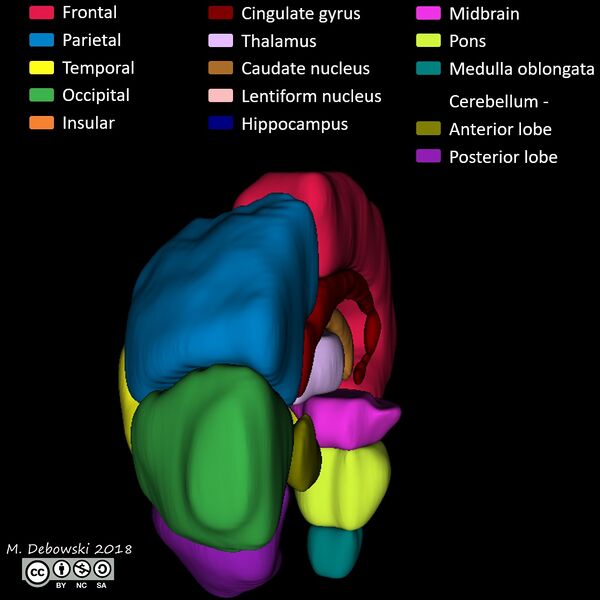 File:Brain lobes - annotated MRI (Radiopaedia 61691-69700 3D reconstruction 68).JPG