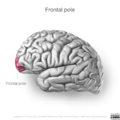 Neuroanatomy- lateral cortex (diagrams) (Radiopaedia 46670-51313 Frontal pole 1).png