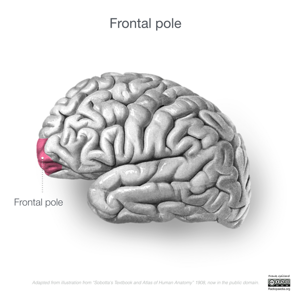 File:Neuroanatomy- lateral cortex (diagrams) (Radiopaedia 46670-51313 Frontal pole 1).png