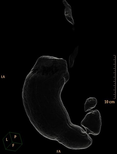 File:Normal CT virtual gastroscopy (Radiopaedia 29960-30501 3D Transparency view 2).jpg