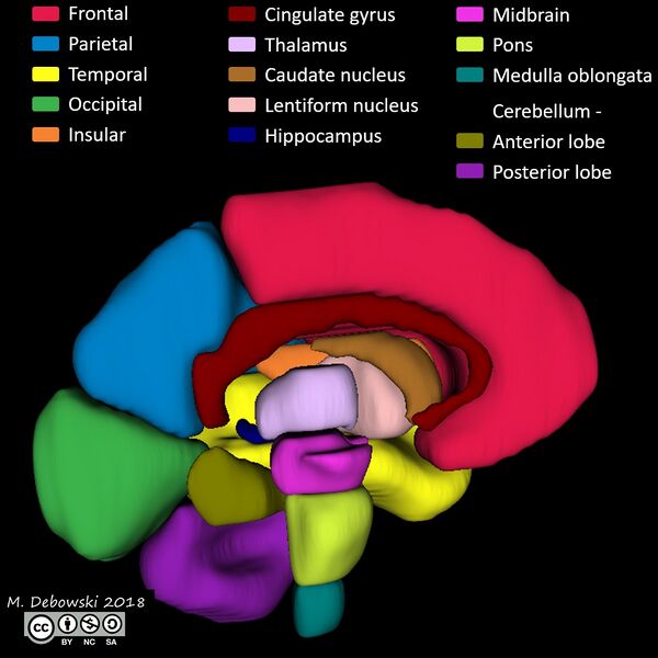 File:Brain lobes - annotated MRI (Radiopaedia 61691-69700 3D reconstruction 85).JPG