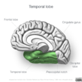 Neuroanatomy- medial cortex (diagrams) (Radiopaedia 47208-51763 Temporal lobe 1).png