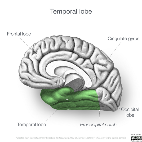File:Neuroanatomy- medial cortex (diagrams) (Radiopaedia 47208-51763 Temporal lobe 1).png