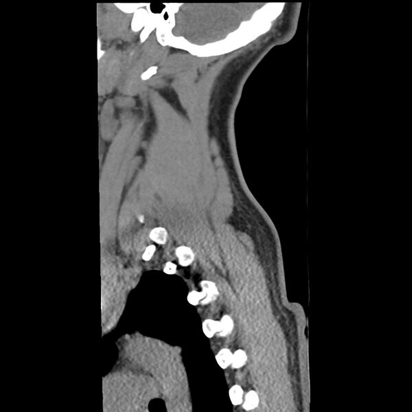 File:Normal trauma spine imaging (Radiopaedia 31753-32686 A 39).jpg
