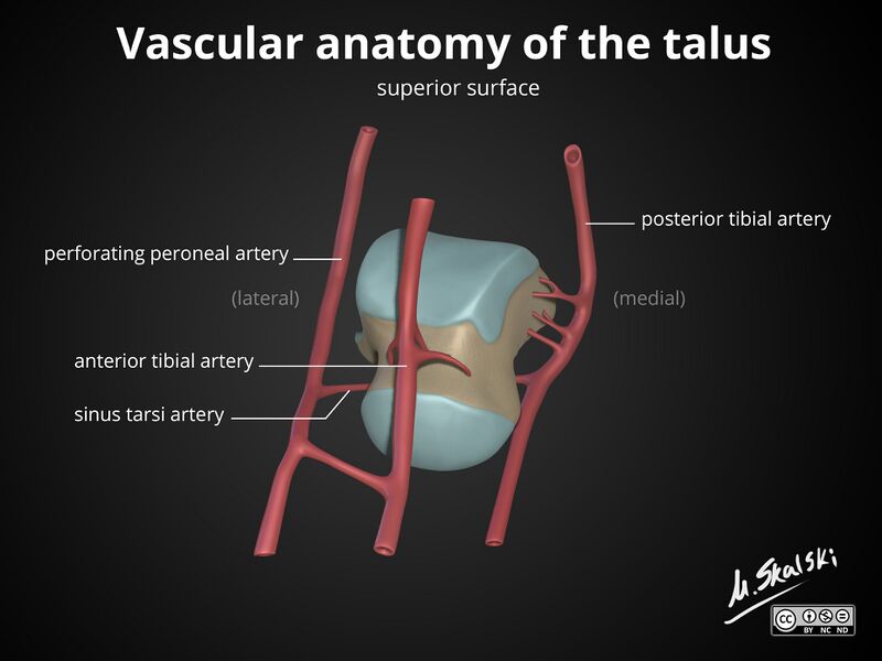 File:Anatomy of the talus (Radiopaedia 31891-32847 B 1).jpg