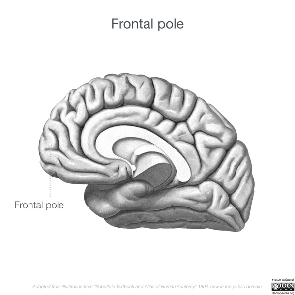 File:Neuroanatomy- medial cortex (diagrams) (Radiopaedia 47208-52697 Frontal pole 2).png