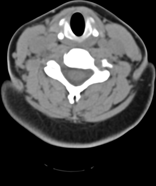 File:Normal cervical spine MRI (including Dixon) (Radiopaedia 42762-45926 Axial non-contrast 35).png