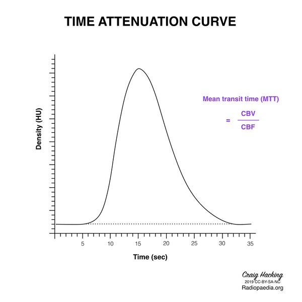 File:Brain perfusion - time attenuation curves (Radiopaedia 70313-80395 MTT 1).jpeg