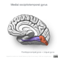 Neuroanatomy- medial cortex (diagrams) (Radiopaedia 47208-52697 J 1).png