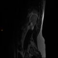 Normal spine MRI (Radiopaedia 77323-89408 Sagittal T2 14).jpg