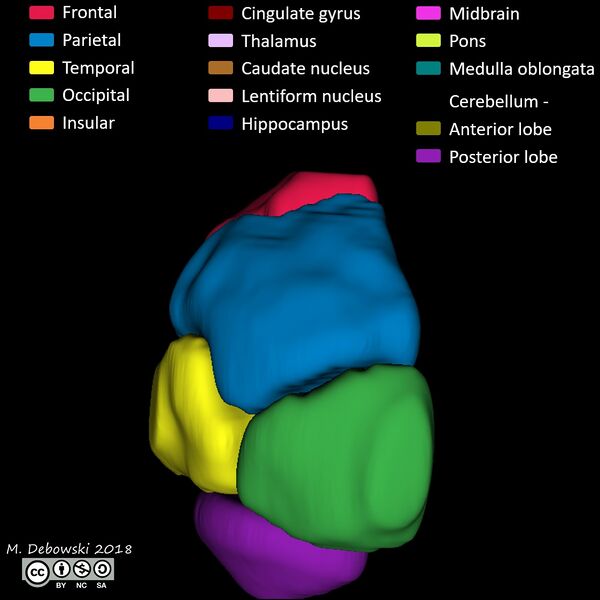 File:Brain lobes - annotated MRI (Radiopaedia 61691-69700 3D reconstruction 60).JPG