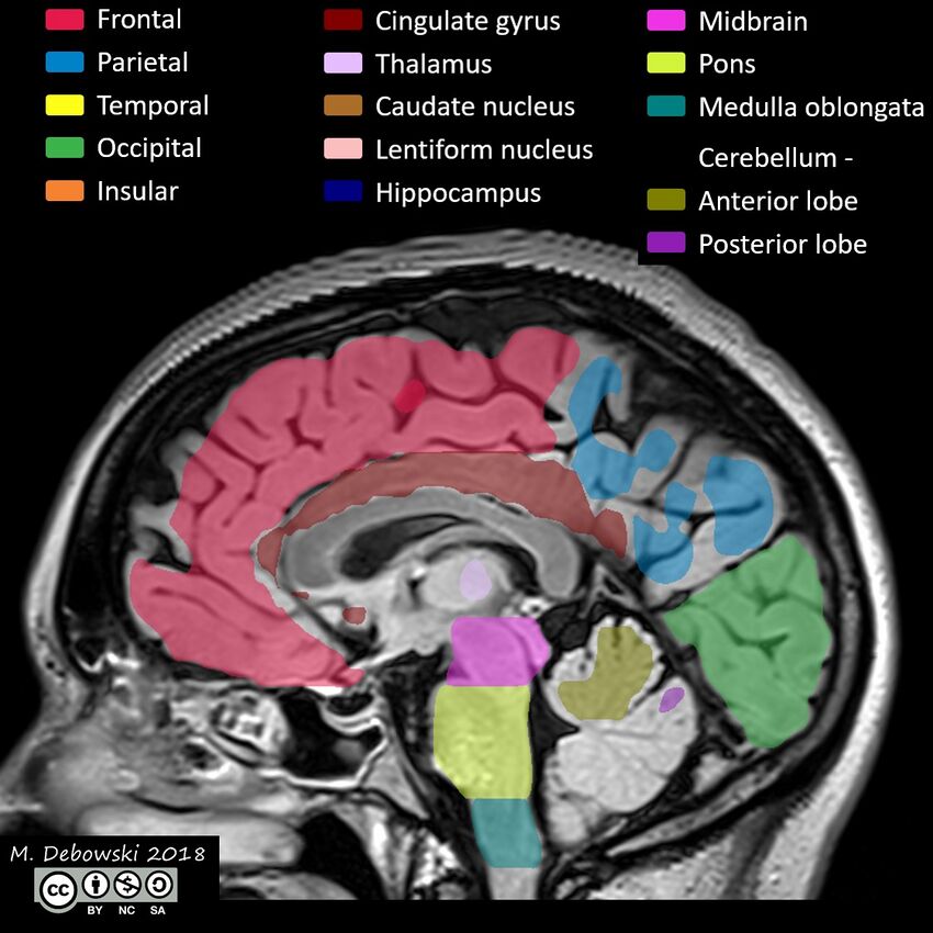 Brain lobes - annotated MRI (Radiopaedia 61691-69700 Sagittal 40).JPG