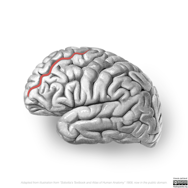 File:Neuroanatomy- lateral cortex (diagrams) (Radiopaedia 46670-51202 A 4).png