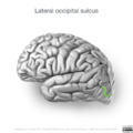 Neuroanatomy- lateral cortex (diagrams) (Radiopaedia 46670-51201 I 4).png