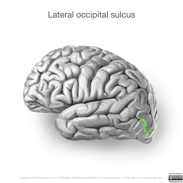 File:Neuroanatomy- lateral cortex (diagrams) (Radiopaedia 46670-51201 I 4).png