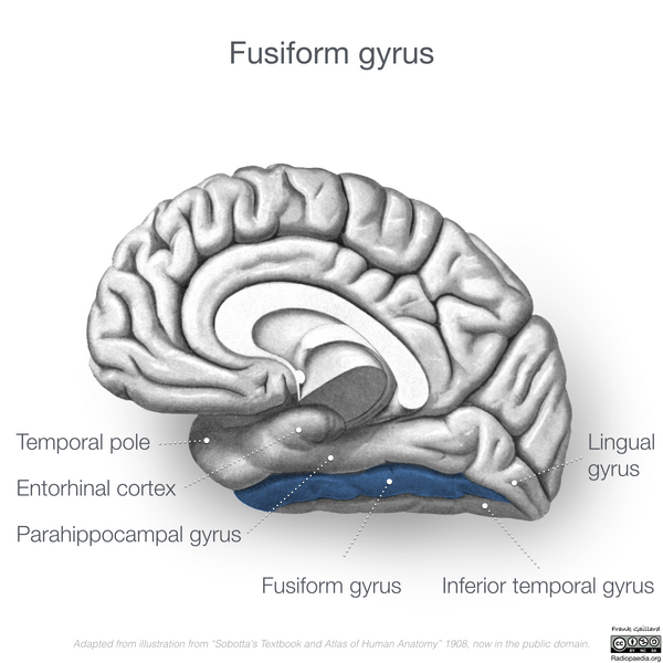 File:Neuroanatomy- medial cortex (diagrams) (Radiopaedia 47208-52697 Fusiform gyrus 2).png