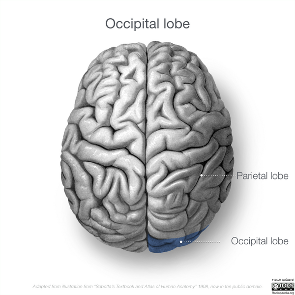 File:Neuroanatomy- superior cortex (diagrams) (Radiopaedia 59317-66669 Occipital lobe 2).png