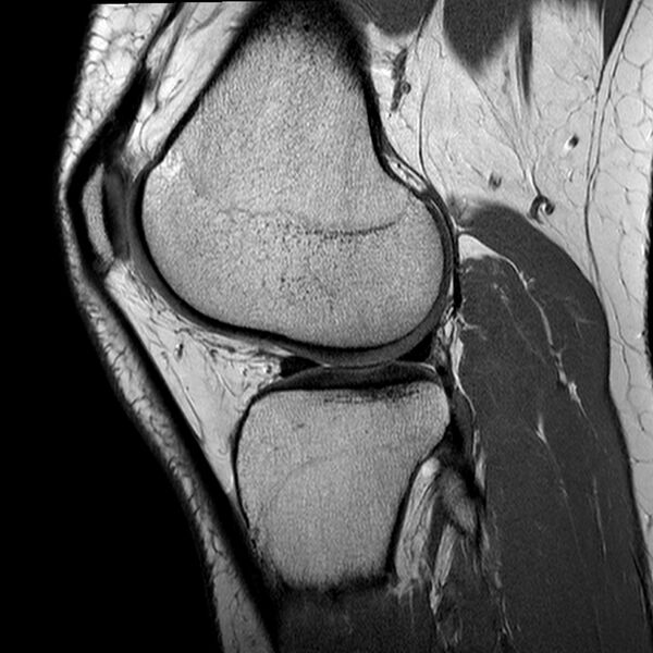 File:Anatomy Quiz (MRI knee) (Radiopaedia 43478-46865 A 19).jpeg