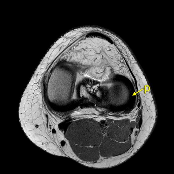 File:Anatomy Quiz (MRI knee) (Radiopaedia 43478-46866 A 17).jpeg
