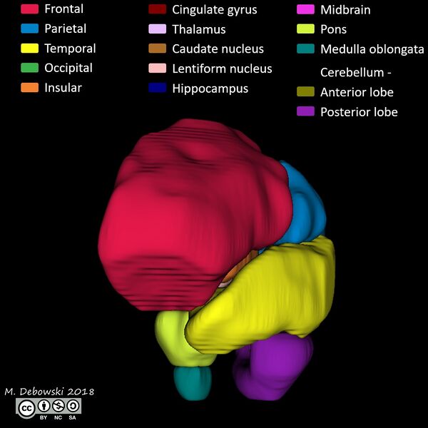File:Brain lobes - annotated MRI (Radiopaedia 61691-69700 3D reconstruction 25).JPG