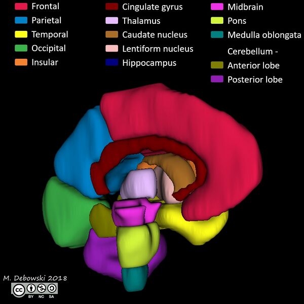 File:Brain lobes - annotated MRI (Radiopaedia 61691-69700 3D reconstruction 5).JPG