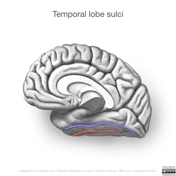 File:Neuroanatomy- medial cortex (diagrams) (Radiopaedia 47208-58969 I 3).png