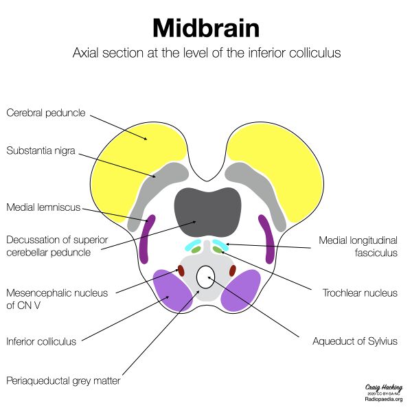 File:Brainstem cross-sectional anatomy (diagrams) (Radiopaedia 81958-95923 Lower midbrain 1).jpeg