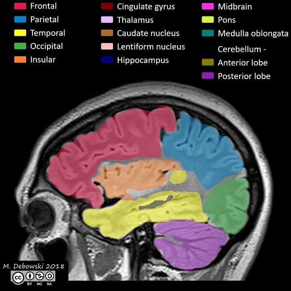 File:Brain lobes - annotated MRI (Radiopaedia 61691-69700 Sagittal 59).JPG