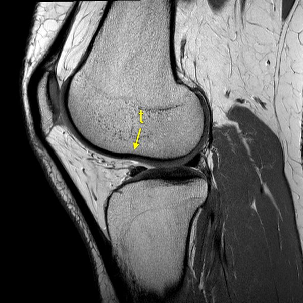 File:Anatomy Quiz (MRI knee) (Radiopaedia 43478-46865 A 18).jpeg