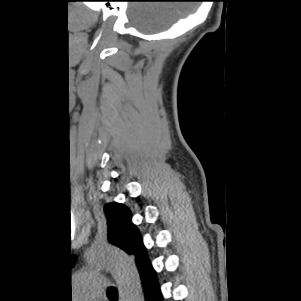 File:Normal trauma spine imaging (Radiopaedia 31753-32686 A 36).jpg